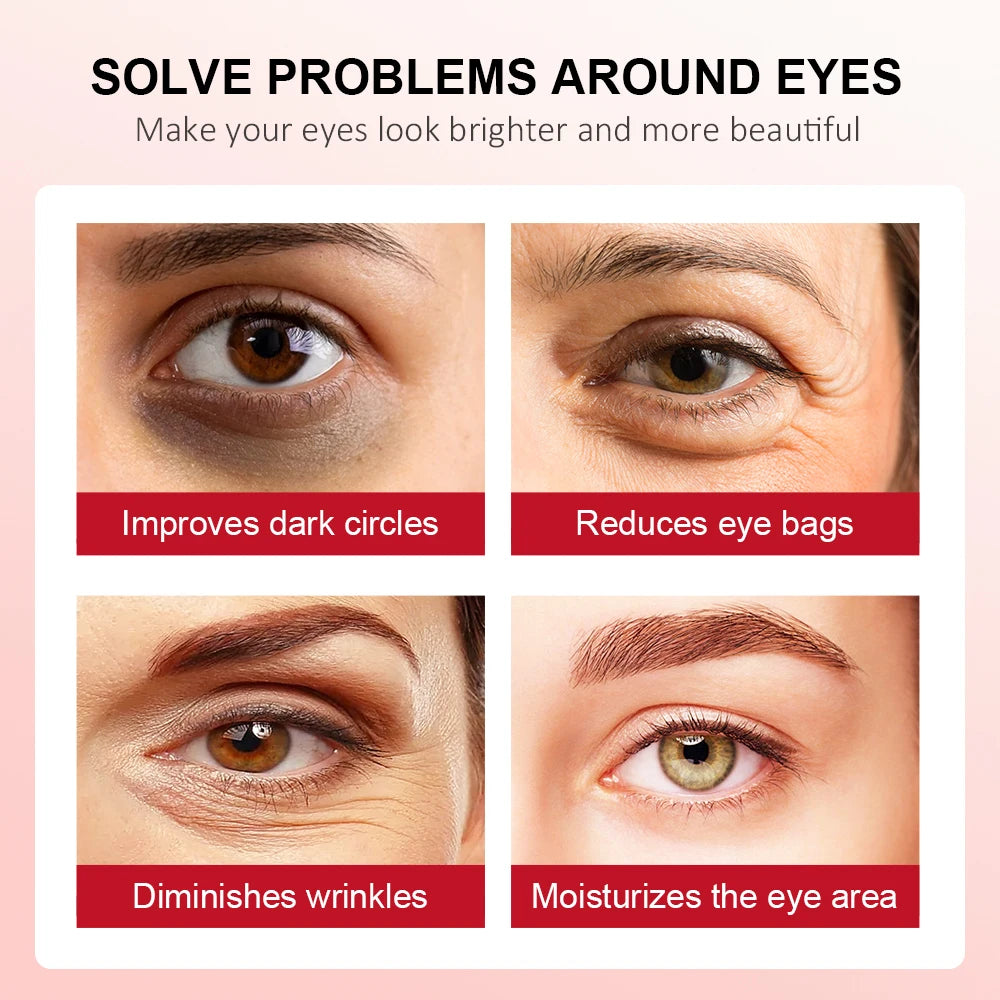 Eye area before-and-after panels for dark circles, wrinkles, and eye bags