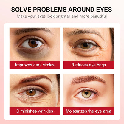 Eye area before-and-after panels for dark circles, wrinkles, and eye bags