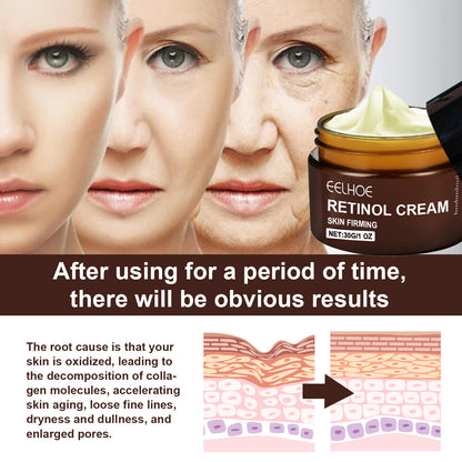 Retinol face cream jar with cream scoop on top and gold label